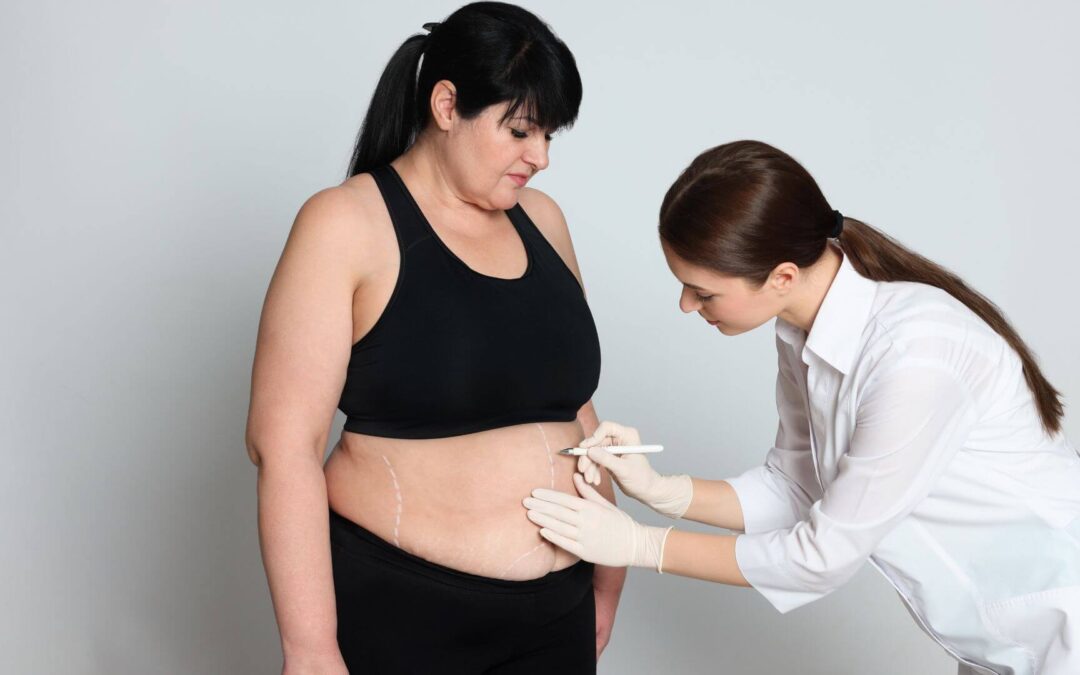 Choosing the Right Medical Weight Loss Program: Factors to Consider